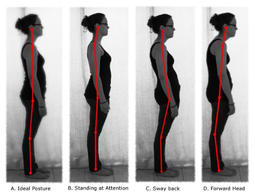 Open up Those Rounded Shoulders! - VerticAlign Posture & Ergonomics